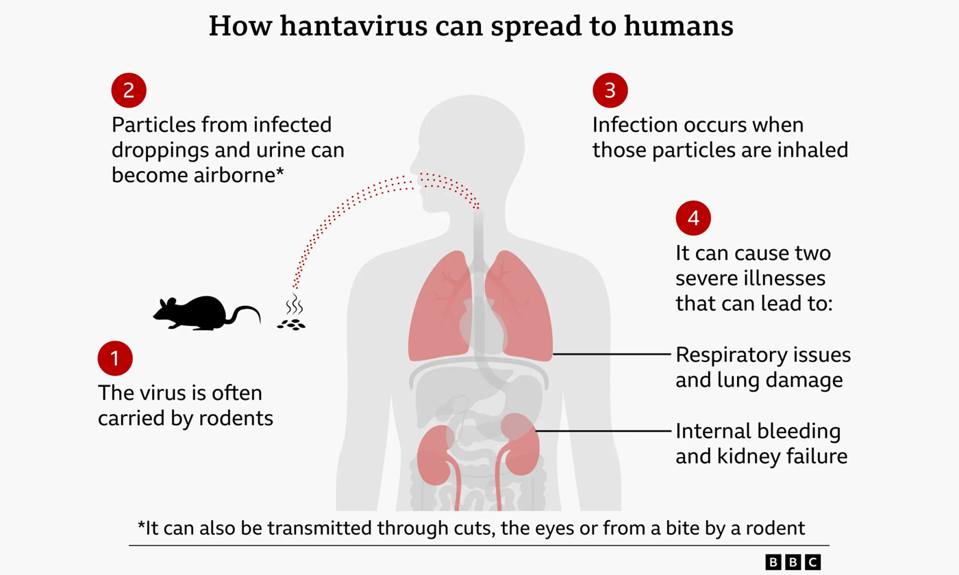 BBC Hantavirus Infographic